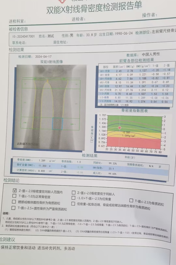 雙能X射線骨密度儀：準(zhǔn)確測量骨密度，助力骨質(zhì)疏松防治，守護(hù)骨骼健康